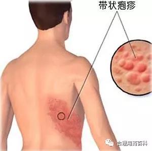 微信图片_20180401212220.jpg