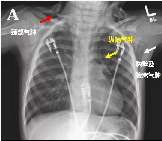 微信图片_20200425210516.jpg