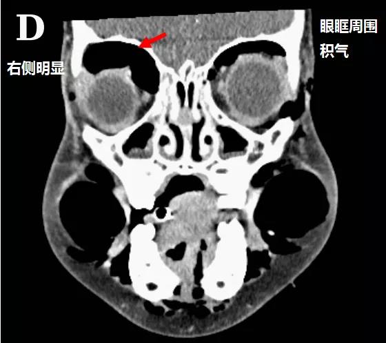 微信图片_20200425210553.jpg