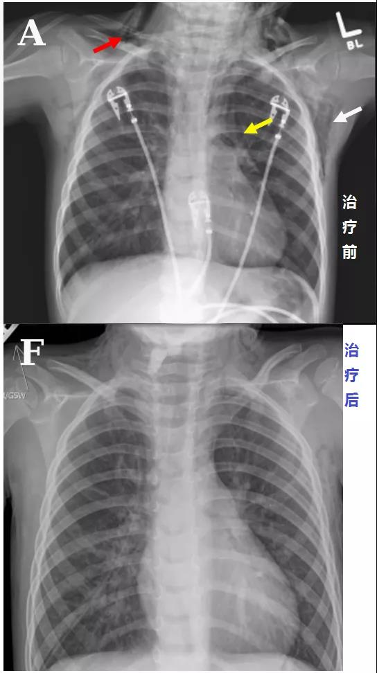 微信图片_20200425210708.jpg
