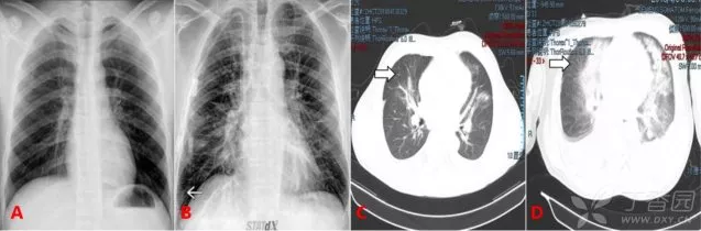 QQ浏览器截图20200505212350.png