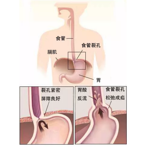 QQ截图20200609164539.png