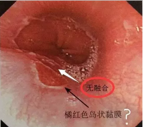 QQ截图20200609165638.png