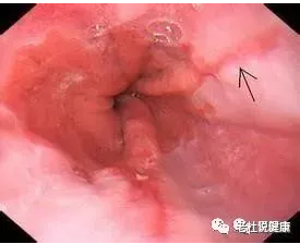 微信截图_20200811170306.png