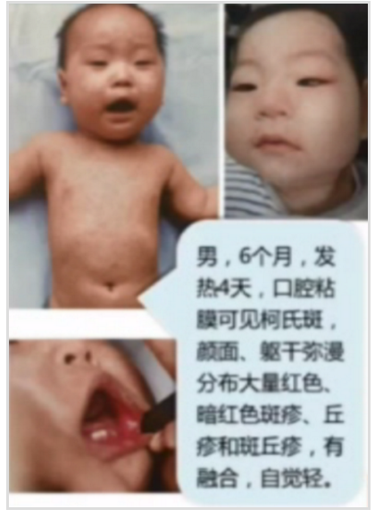 微信截图_20201104155826.png