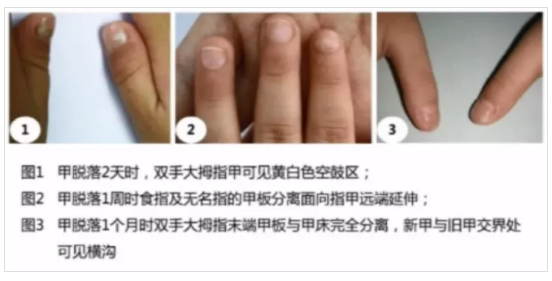 微信截图_20201104160100.png